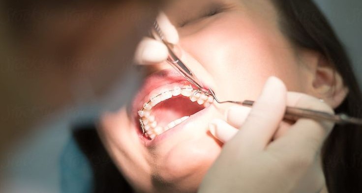 Orthodontic and Surgical Coordination
